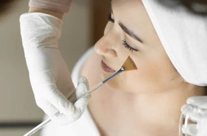 Peeling químicos para profissionais de Estética Curso online